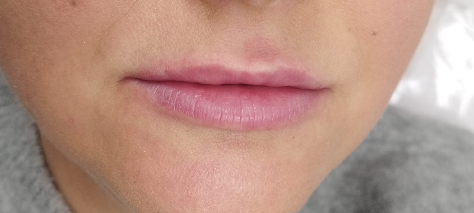 After